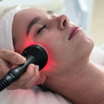 Radio Frequency Skin Tightening