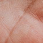 Mending Small Tears Before They Become Holes: Fix Them Early