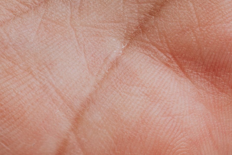 Mending Small Tears Before They Become Holes: Fix Them Early